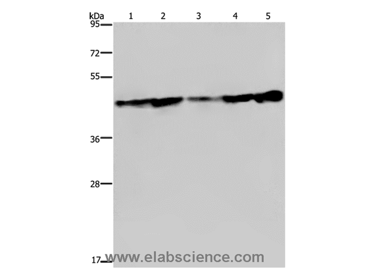 Western Blot analysis of Human fetal liver tissue, HT-29 and HUVEC cell, MCF-7 cell and Human hepatocellular carcinoma tissue using CERS4 Polyclonal Antibody at dilution of 1:300