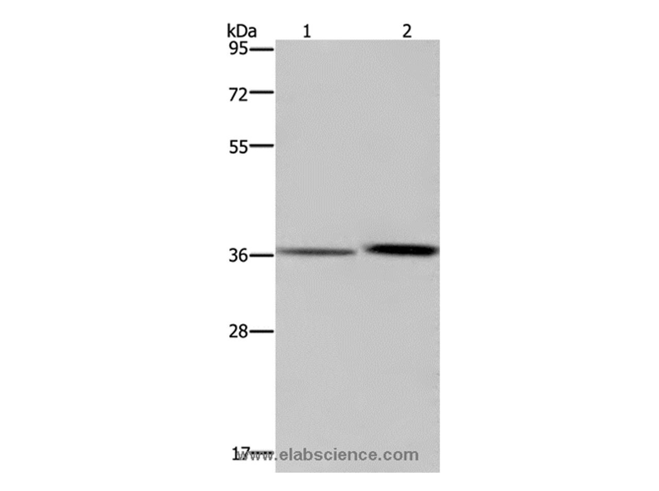 Western Blot analysis of A549 cell and Human fetal liver tissue using MAGEF1 Polyclonal Antibody at dilution of 1:300