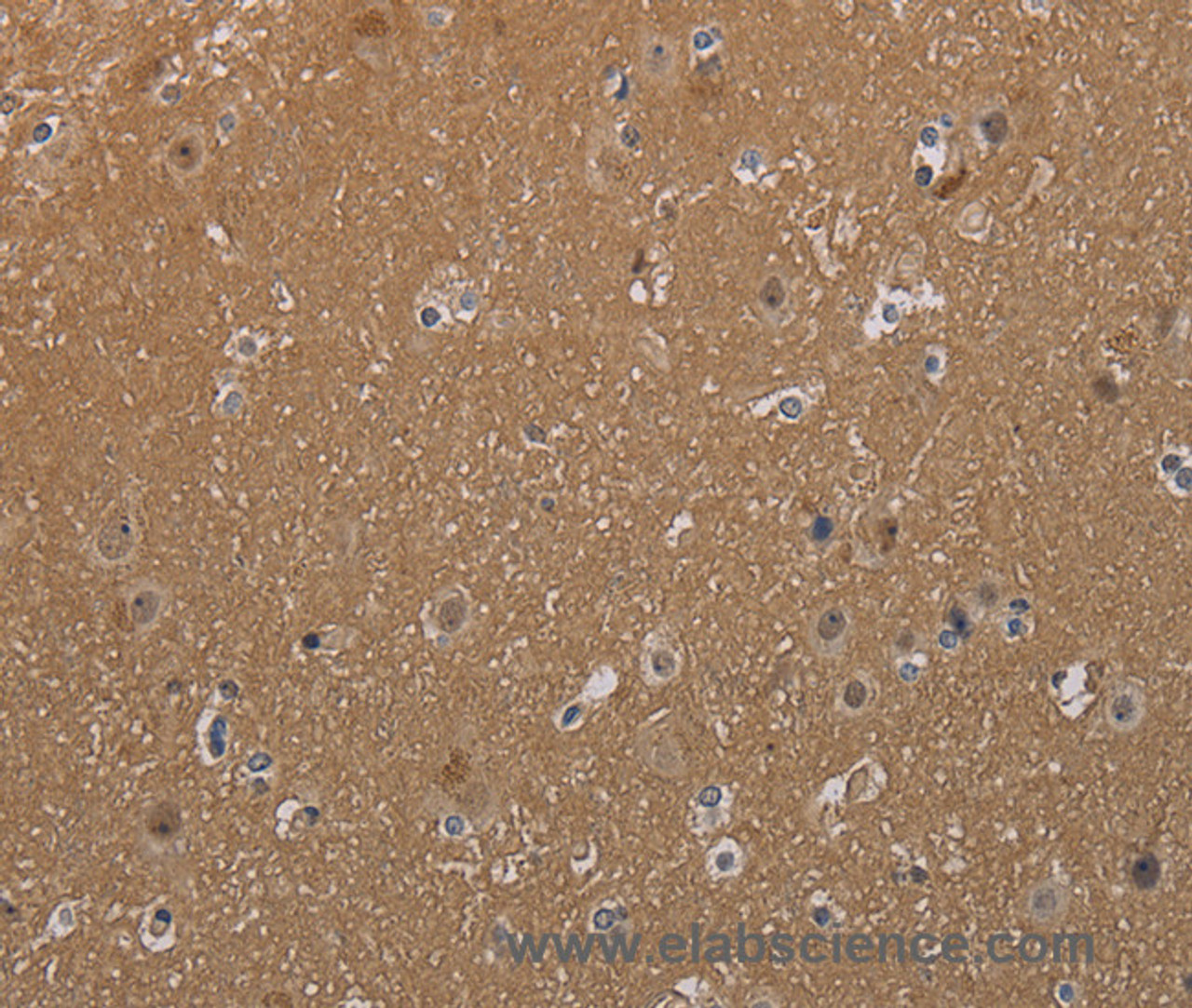 Immunohistochemistry of paraffin-embedded Human brain tissue using MAGEL2 Polyclonal Antibody at dilution 1:40