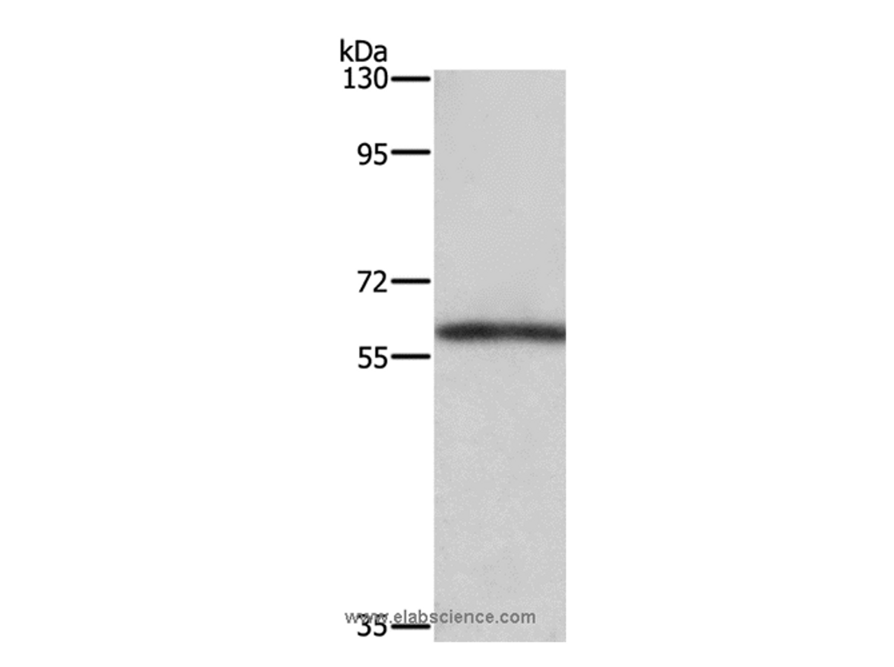 Western Blot analysis of Mouse kidney tissue using TBX5 Polyclonal Antibody at dilution of 1:350