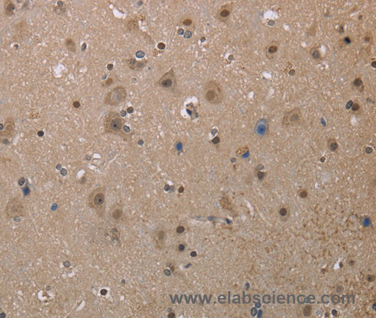 Immunohistochemistry of paraffin-embedded Human brain  tissue using MGLL Polyclonal Antibody at dilution 1:40
