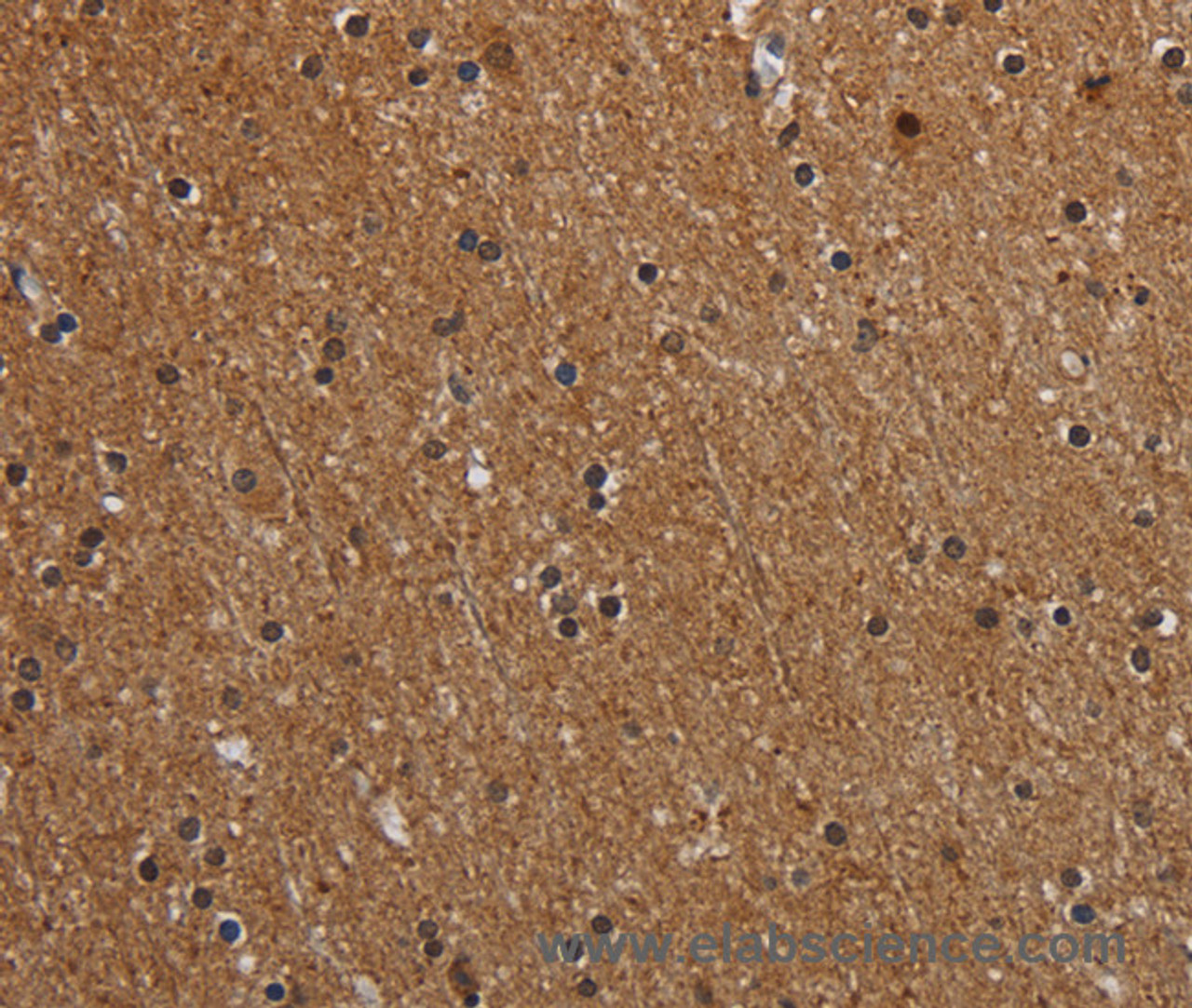 Immunohistochemistry of paraffin-embedded Human brain  using MT-ND1 Polyclonal Antibody at dilution of 1:50