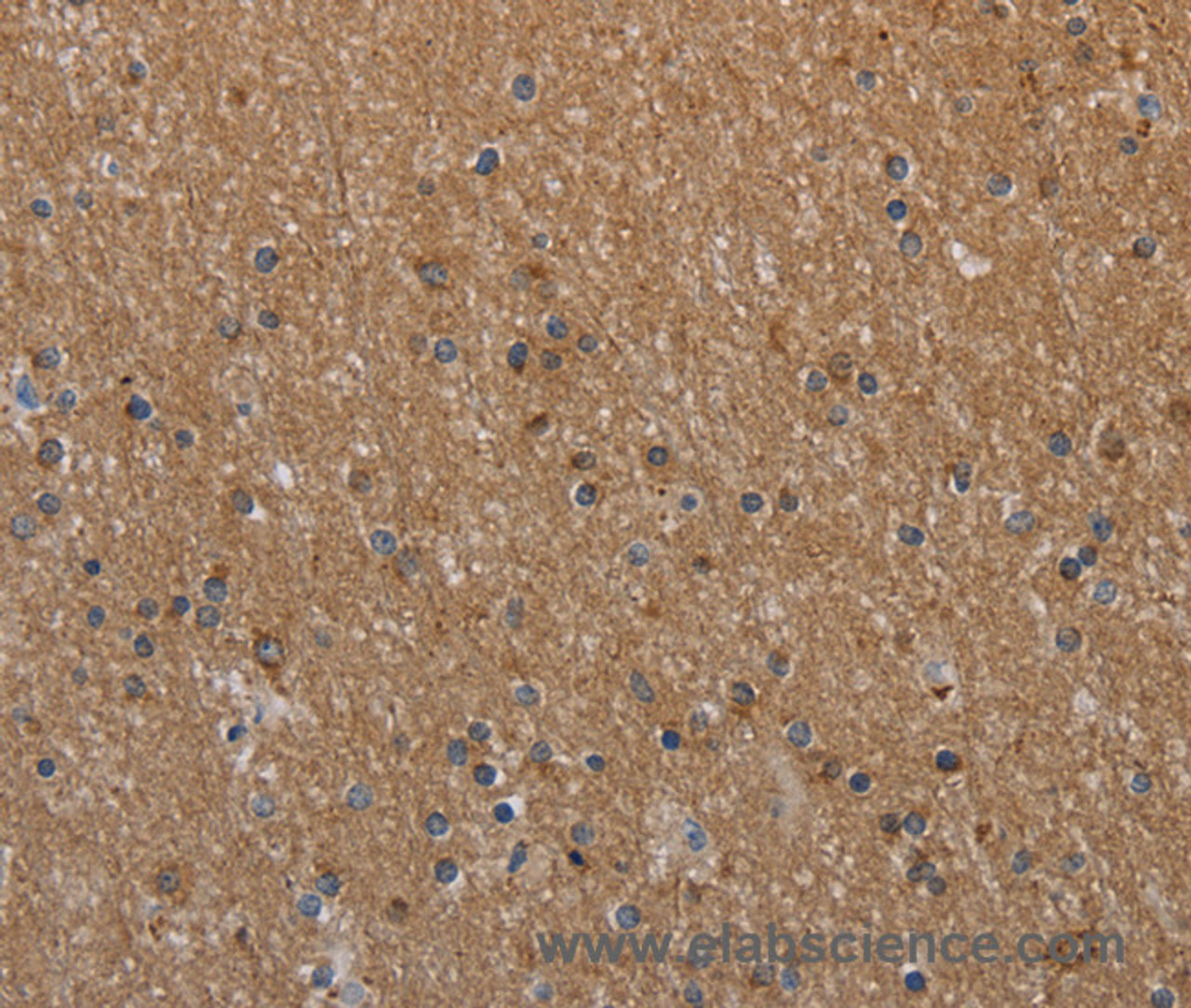 Immunohistochemistry of paraffin-embedded Human brain  tissue using NAA25 Polyclonal Antibody at dilution 1:40