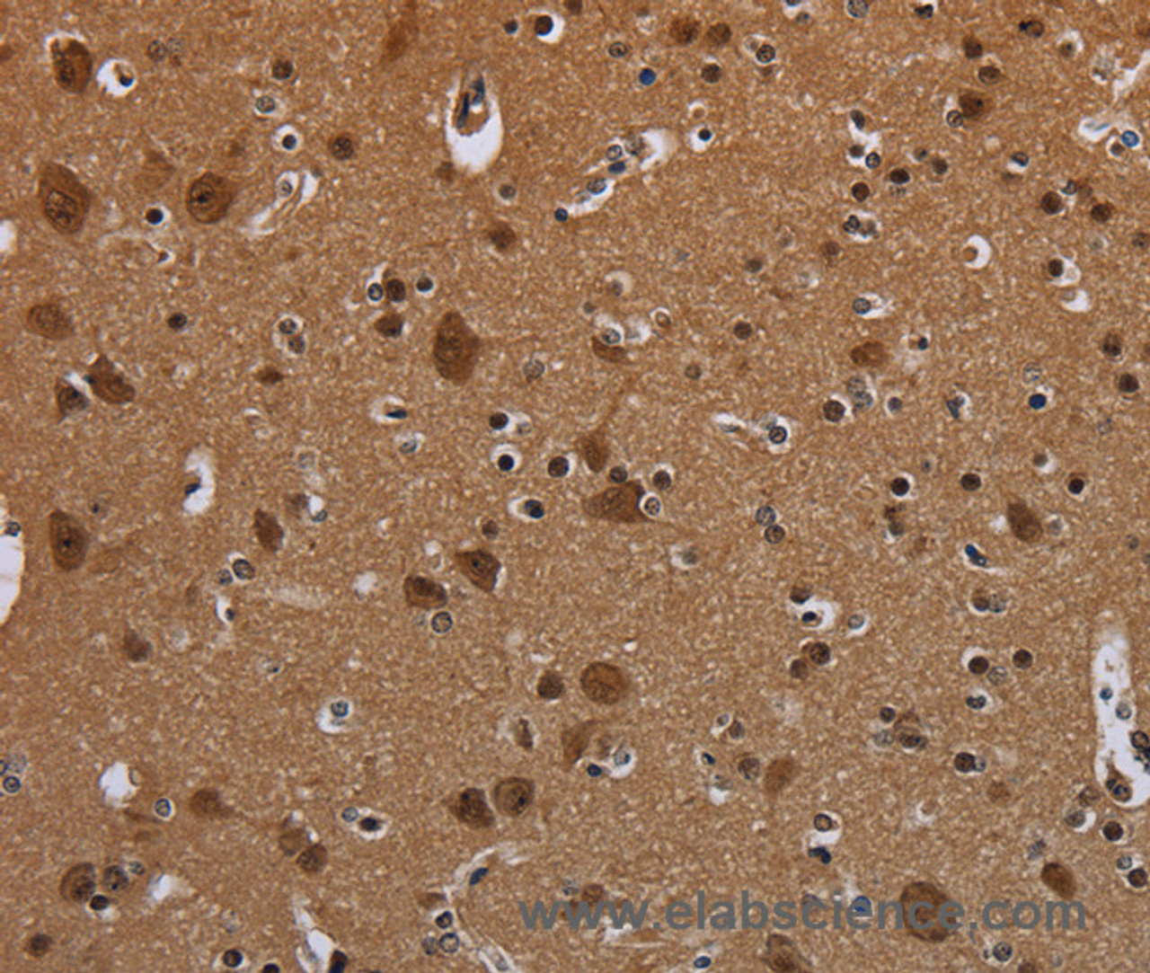 Immunohistochemistry of paraffin-embedded Mouse brain using MYCN Polyclonal Antibody at dilution 1:35