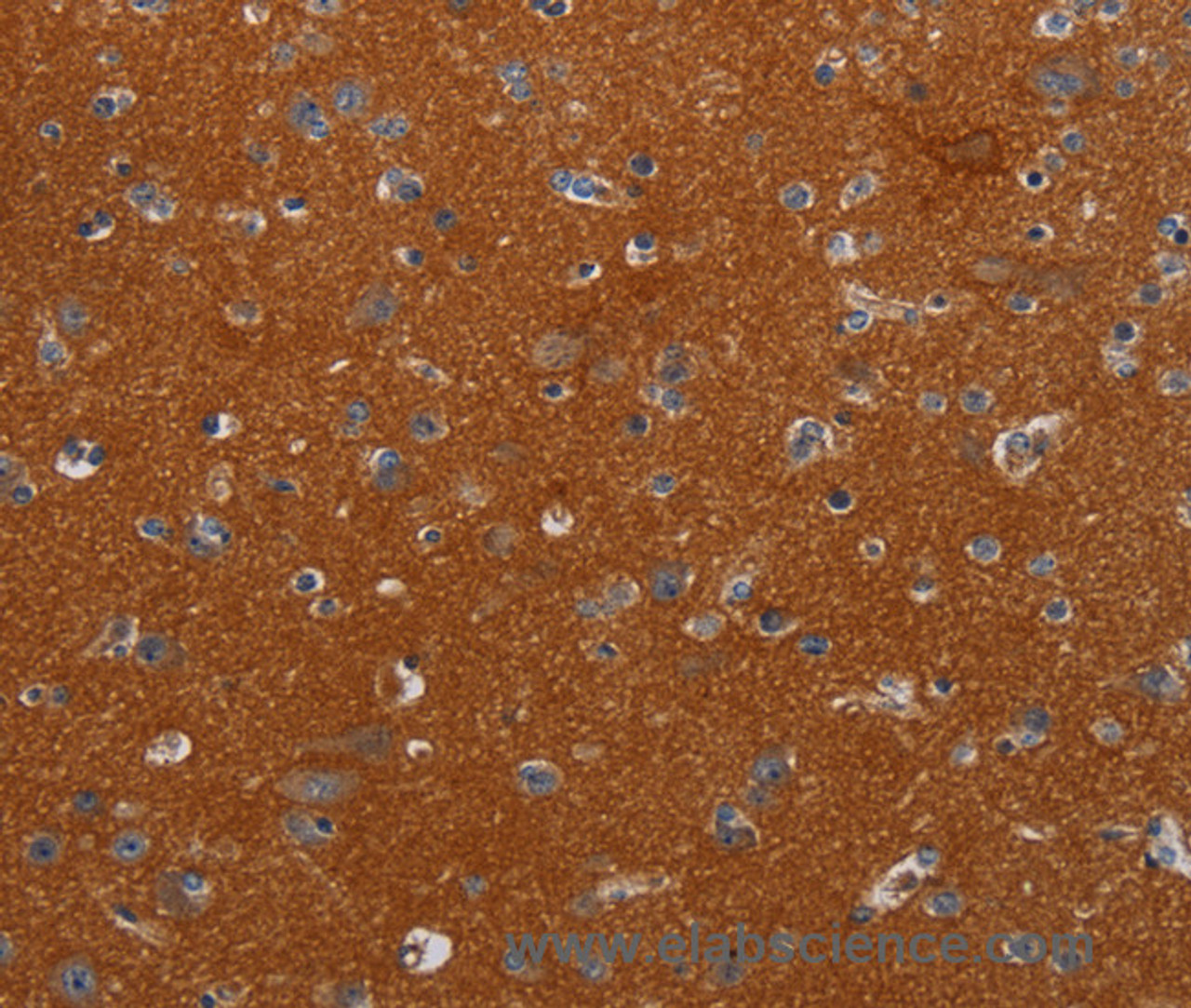 Immunohistochemistry of paraffin-embedded Human brain tissue using NOX3 Polyclonal Antibody at dilution 1:40