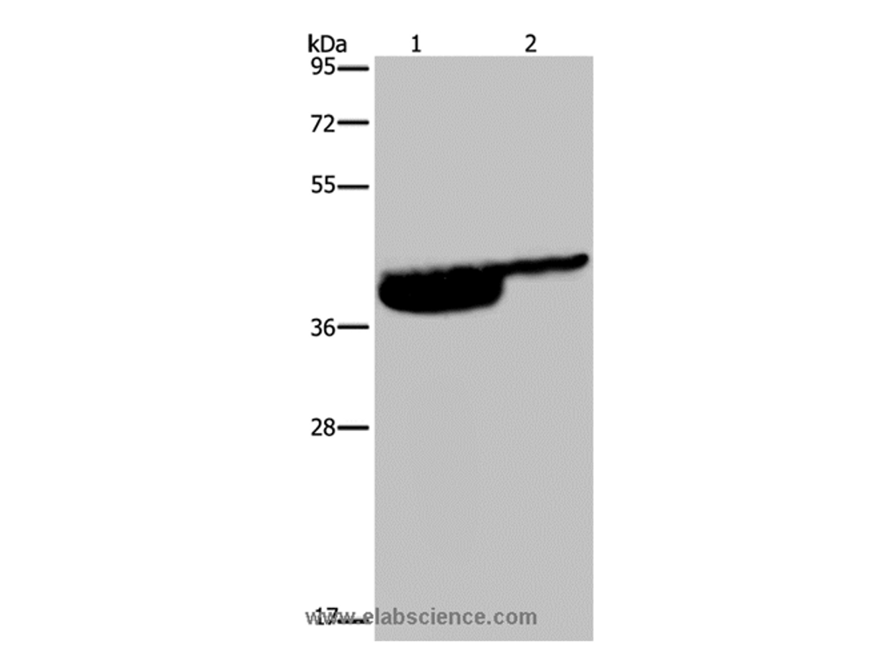 Western Blot analysis of Human bladder and bladder transitional cell carcinoma tissue using P2RX3 Polyclonal Antibody at dilution of 1:250
