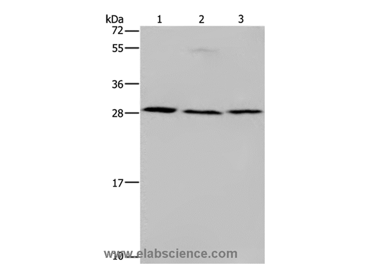 Western Blot analysis of Human fetal liver tissue, 293T and 231 cell using TP53INP1 Polyclonal Antibody at dilution of 1:200