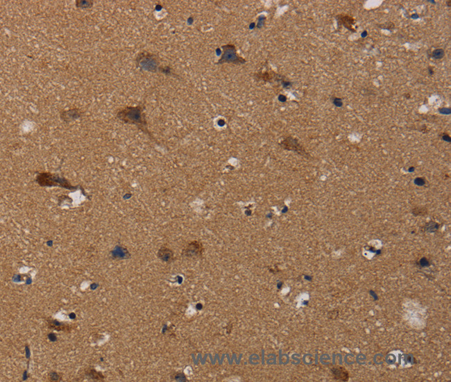 Immunohistochemistry of paraffin-embedded Human brain using TP53INP1 Polyclonal Antibody at dilution of 1:50