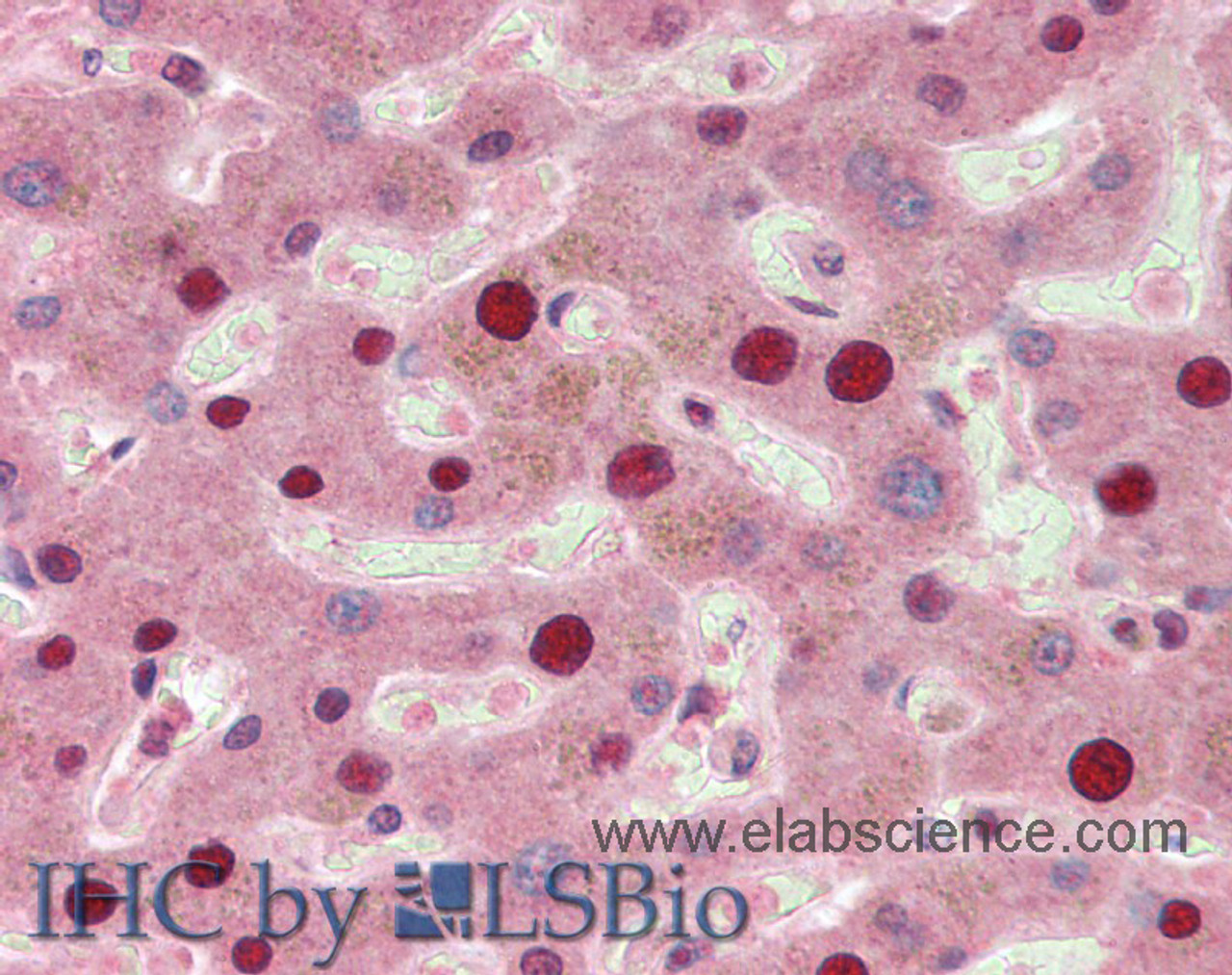 Immunohistochemistry of paraffin-embedded Liver tissue using TP53INP1 Polyclonal Antibody at dilution of 1:50(Elabscience® Product Detected by Lifespan).