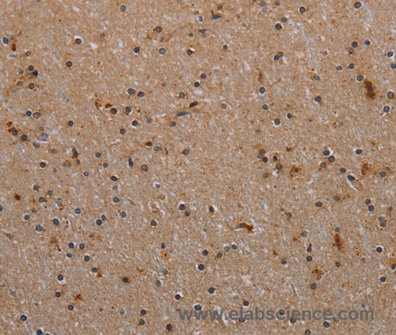 Immunohistochemistry of paraffin-embedded Human brain tissue using p70 S6 kinase beta Polyclonal Antibody at dilution 1:40