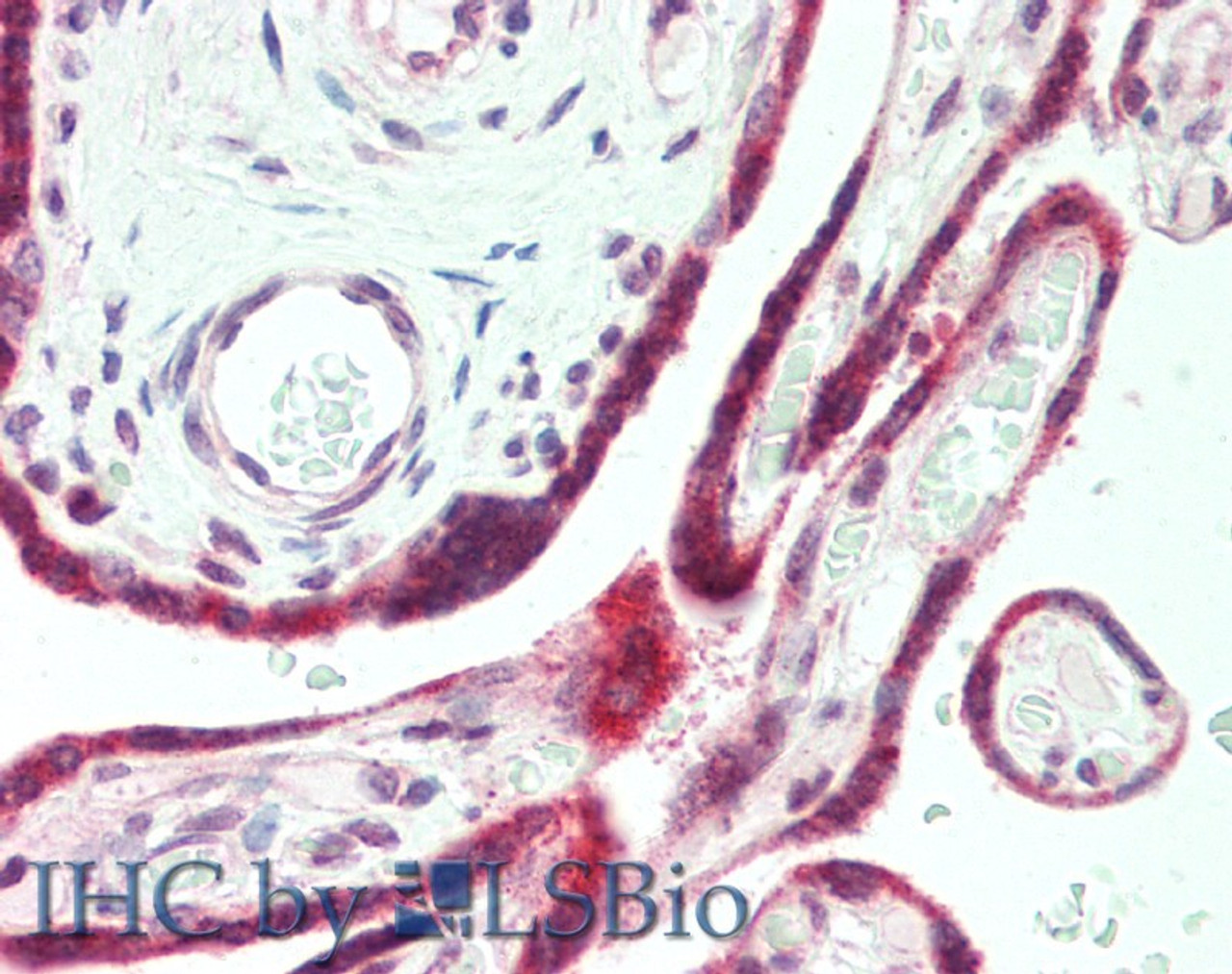 Immunohistochemistry of paraffin-embedded Human Placenta using PAPPA Polyclonal Antibody at dilution of 1:100(Elabscience® Product Detected by Lifespan).