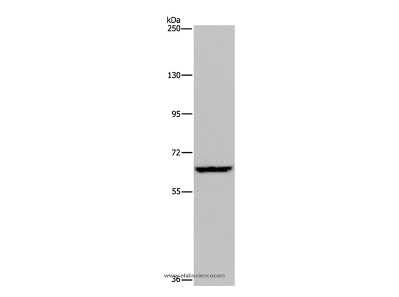 Western Blot analysis of Hela cell using IVL Polyclonal Antibody at dilution of 1:200