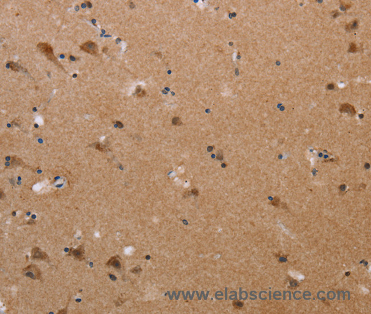 Immunohistochemistry of paraffin-embedded Human brain  tissue using PLXNA4 Polyclonal Antibody at dilution 1:50