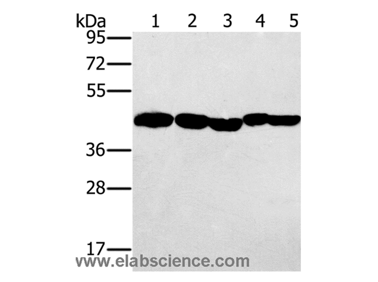 Western Blot analysis of Hela, skov3 and A549 cell, Mouse liver and Human ovarian cancer tissue using PON1 Polyclonal Antibody at dilution of 1:500