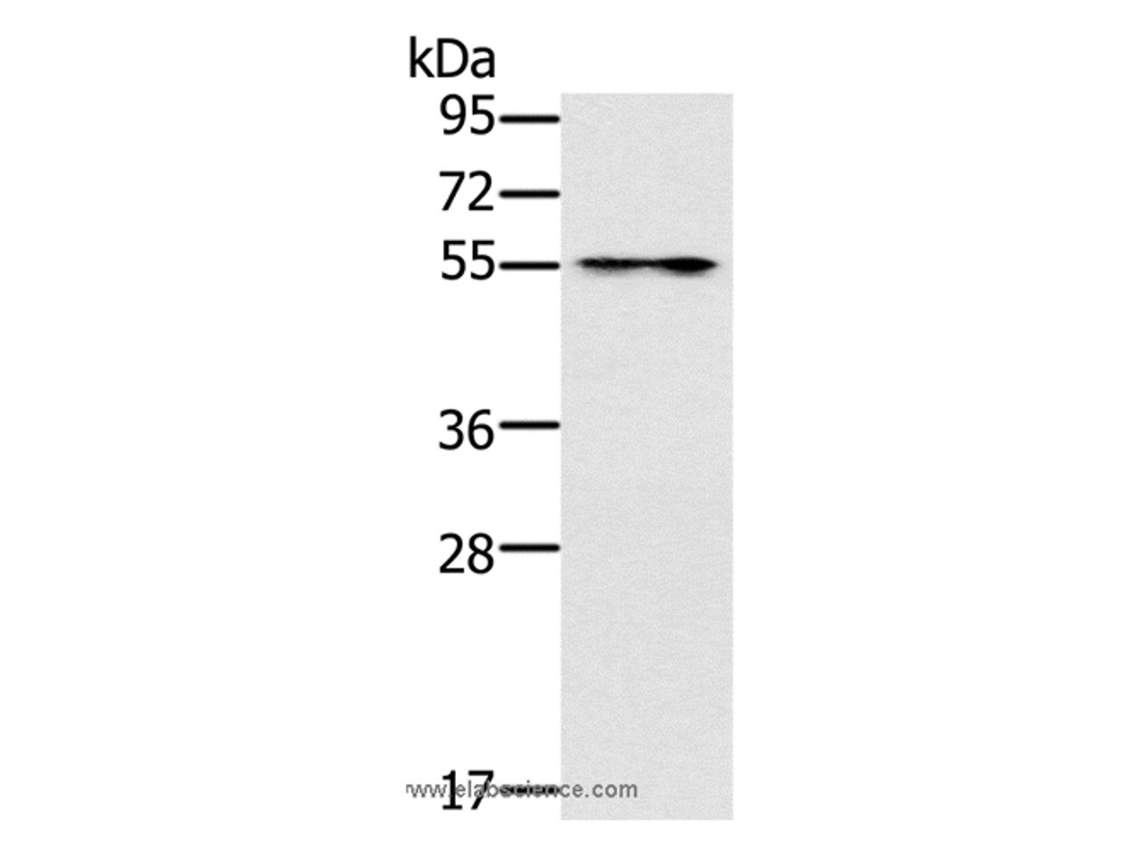 Western Blot analysis of Mouse intestinum tenue tissue using PUS10 Polyclonal Antibody at dilution of 1:200