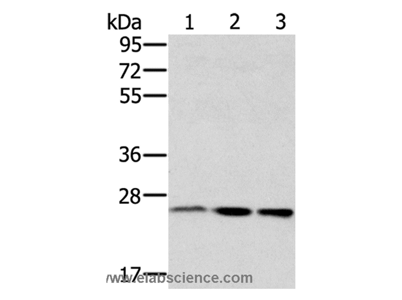 Western Blot analysis of Hela, hepg2 and Raw264.7 cell using RAB8A Polyclonal Antibody at dilution of 1:650