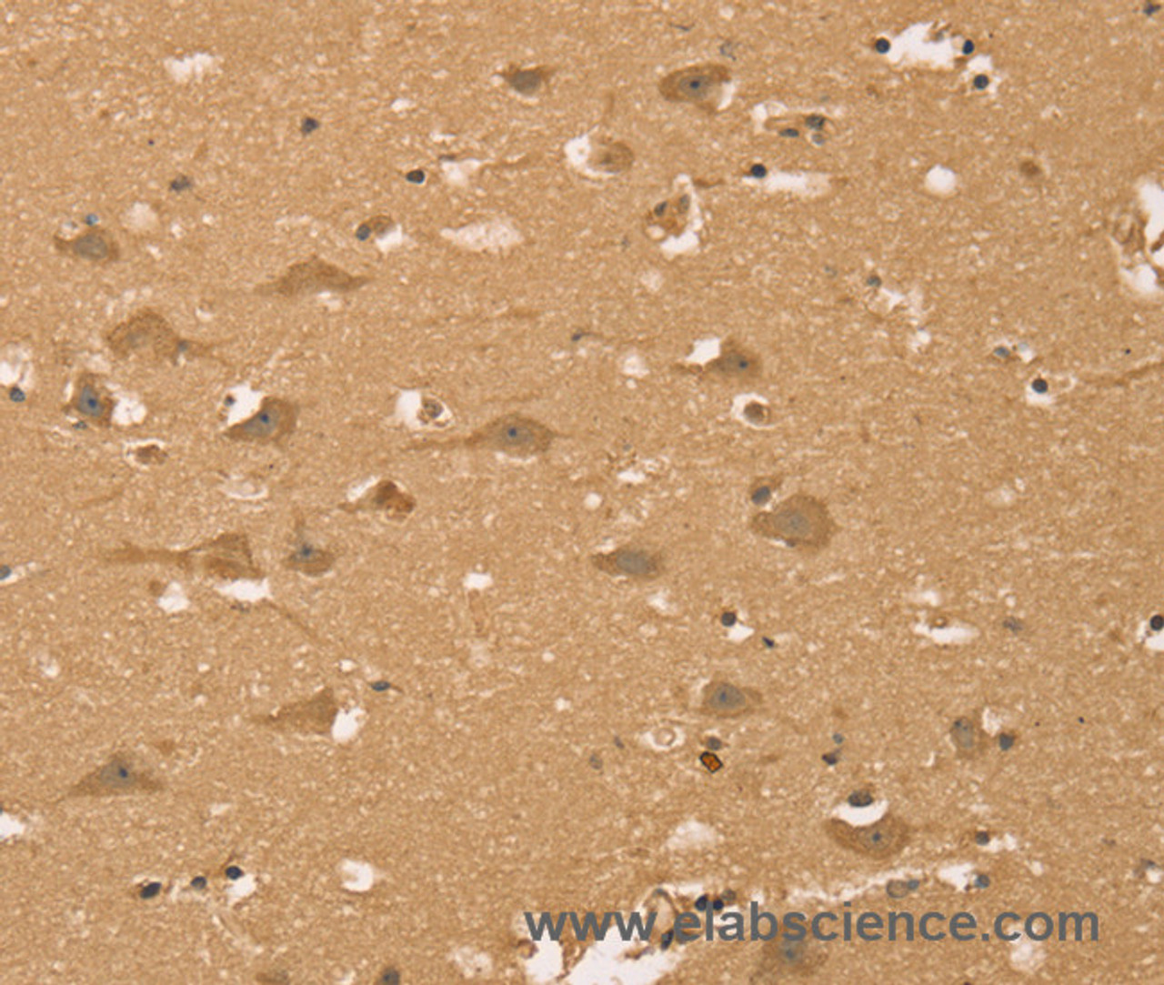 Immunohistochemistry of paraffin-embedded Human brain  using HIF1AN Polyclonal Antibody at dilution of 1:40