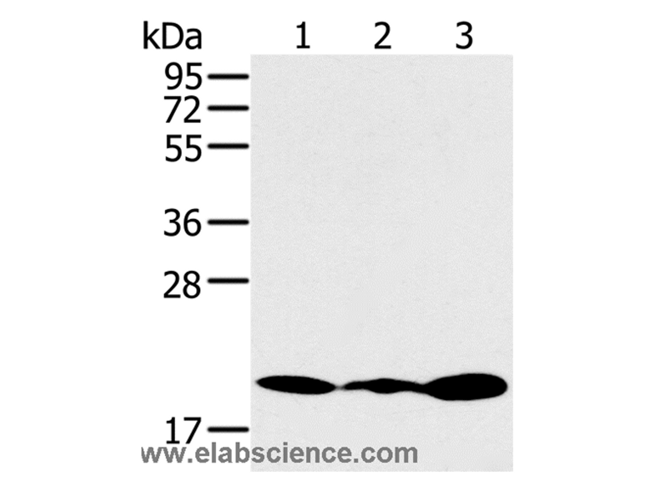 Western Blot analysis of Jurkat, 231 and K562 cell using RNF5 Polyclonal Antibody at dilution of 1:200