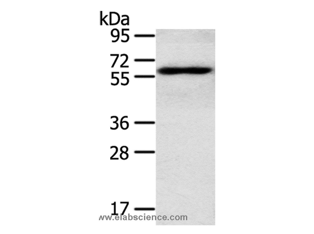 Western Blot analysis of TM4 cell using RORA Polyclonal Antibody at dilution of 1:400