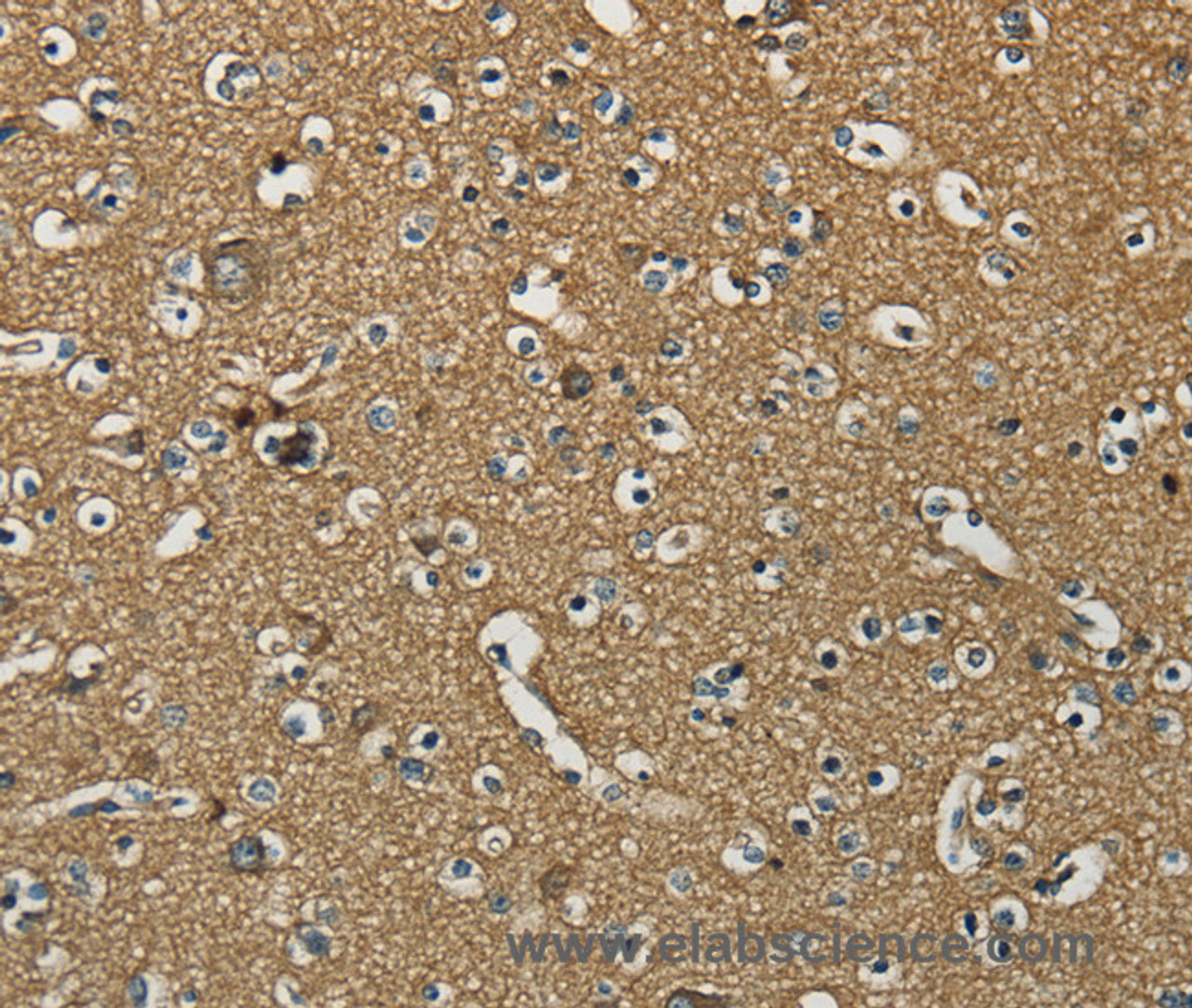 Immunohistochemistry of paraffin-embedded Human brain using NEMF Polyclonal Antibody at dilution of 1:30