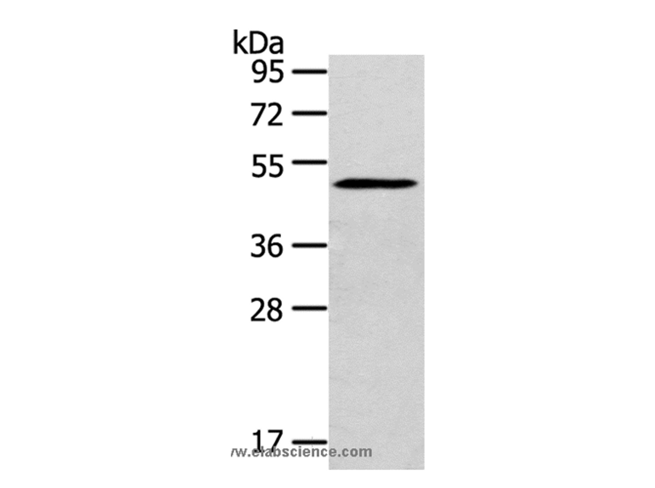 Western Blot analysis of Mouse bladder tissue using SIGLEC15 Polyclonal Antibody at dilution of 1:200