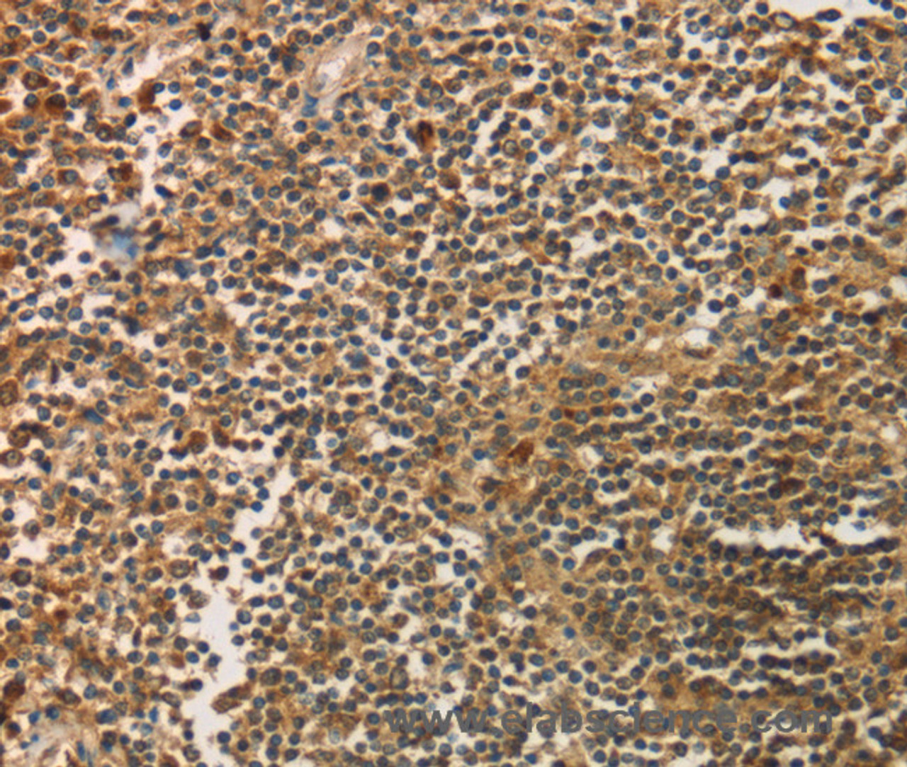 Immunohistochemistry of paraffin-embedded Human tonsil using SIGLEC15 Polyclonal Antibody at dilution of 1:35