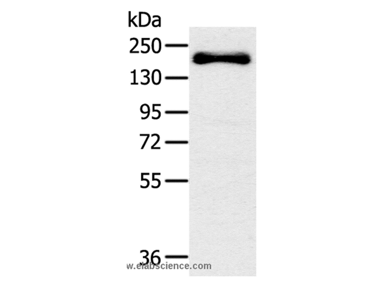 Western Blot analysis of Mouse bladder tissue using SLIT2 Polyclonal Antibody at dilution of 1:200