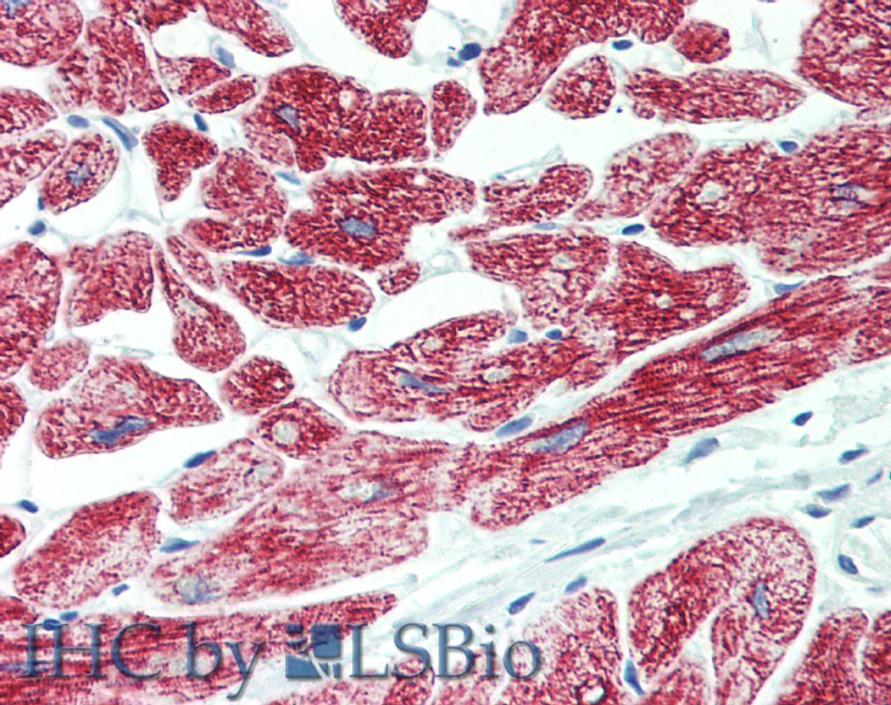 Immunohistochemistry of paraffin-embedded Heart tissue using ROR1 Polyclonal Antibody at dilution of 1:90 (Elabscience® Product Detected by Lifespan).
