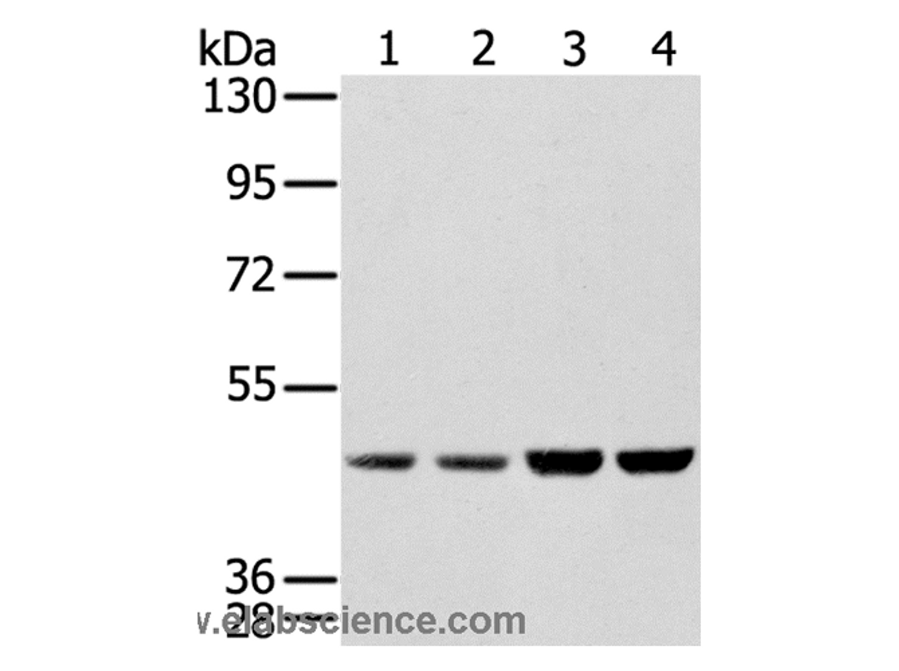 Western Blot analysis of Hela, Raji, 231 and K562 cell using SSB Polyclonal Antibody at dilution of 1:400