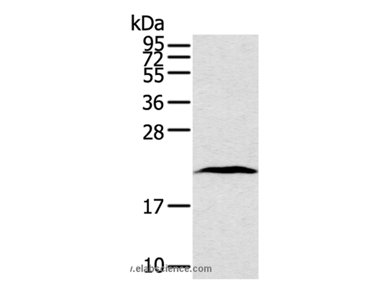 Western Blot analysis of Human lung cancer tissue using TAF10 Polyclonal Antibody at dilution of 1:400