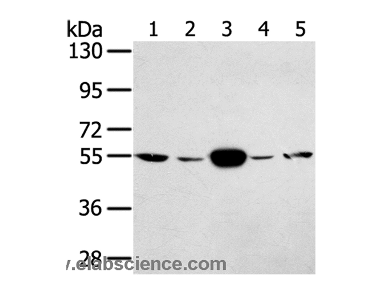 Western Blot analysis of Hela and K562 cell, Human fetal muscle tissue, A375 and hepg2 cell using TRIM35 Polyclonal Antibody at dilution of 1:400