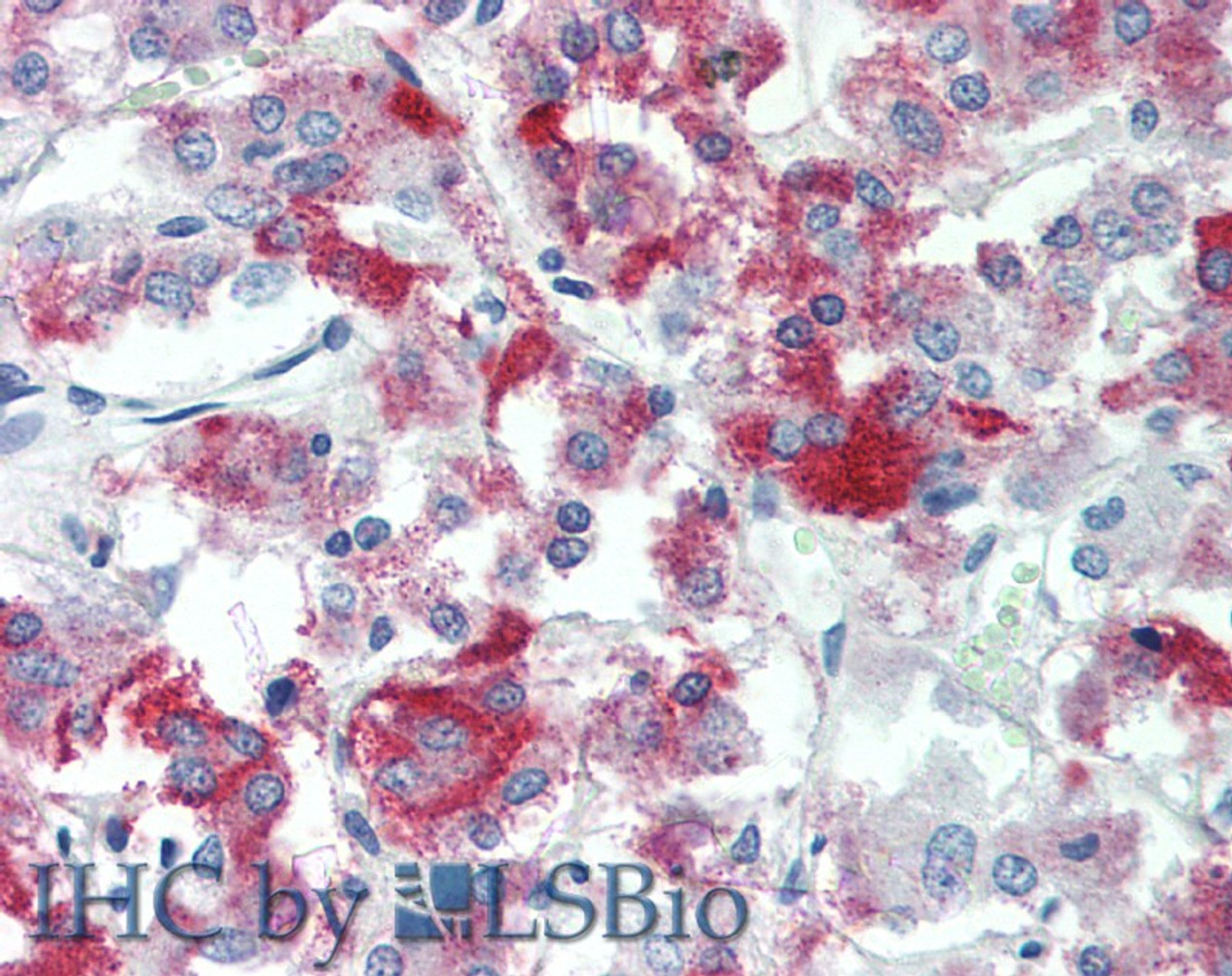 Immunohistochemistry of paraffin-embedded Adrenal tissue using TMEFF2 Polyclonal Antibody at dilution of 1:90 (Elabscience® Product Detected by Lifespan).