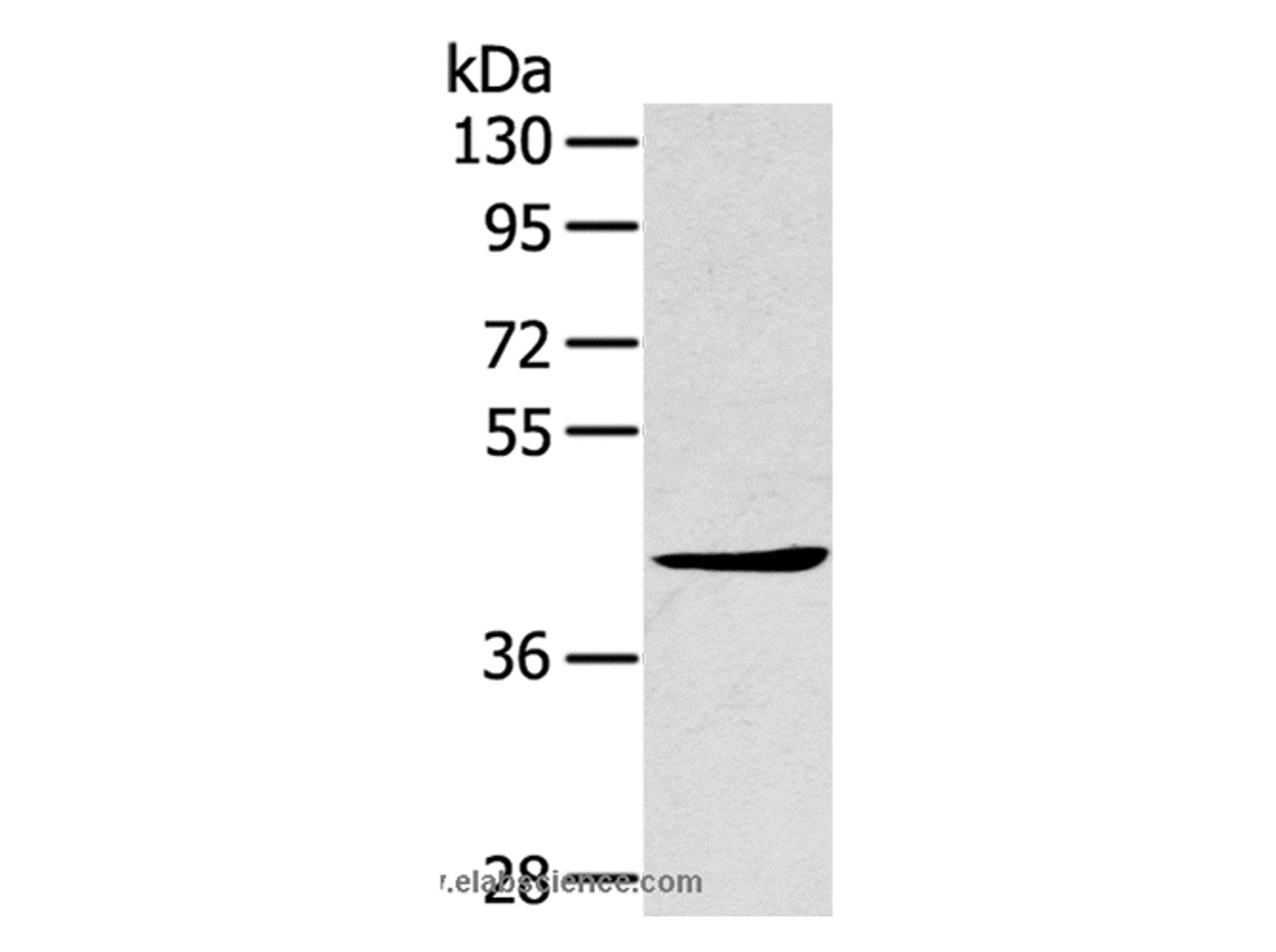 Western Blot analysis of A431 cell using TNIP2 Polyclonal Antibody at dilution of 1:500