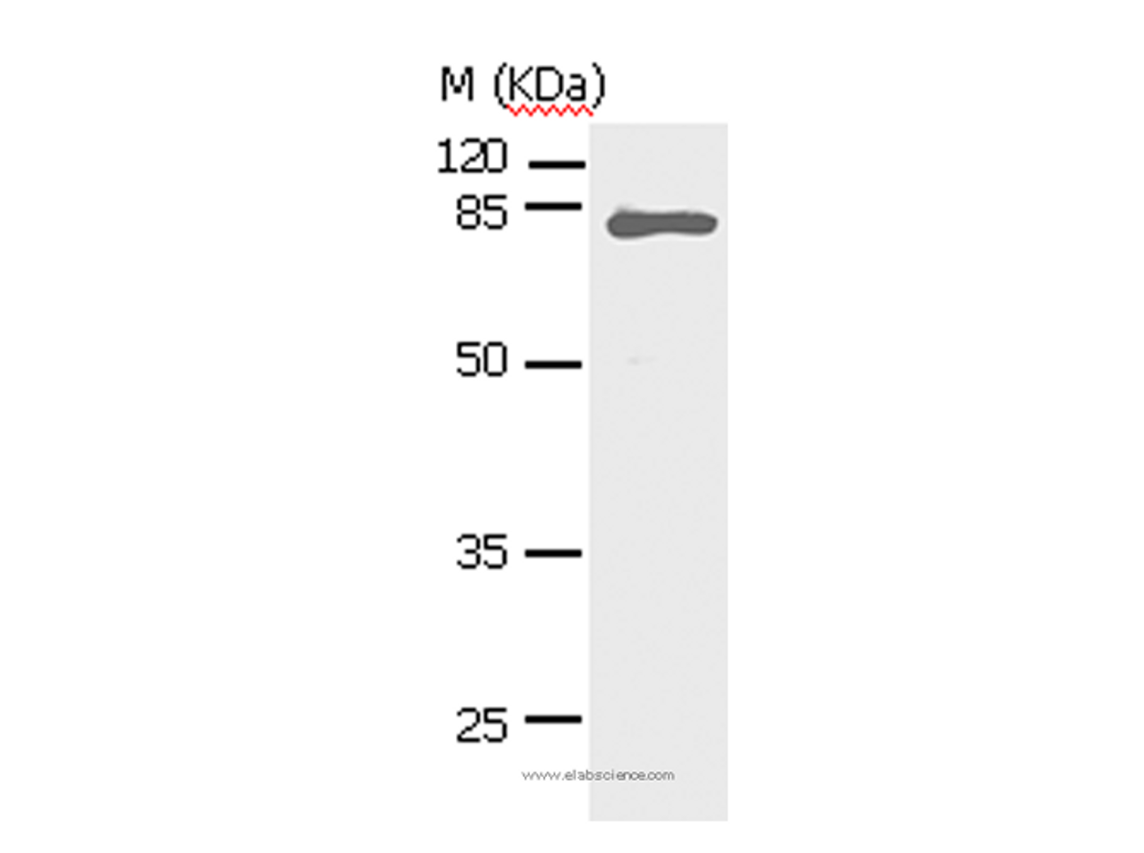 Western Blot analysis of Human fetal lung tissue using STAT5A Polyclonal Antibody at dilution of 1:450