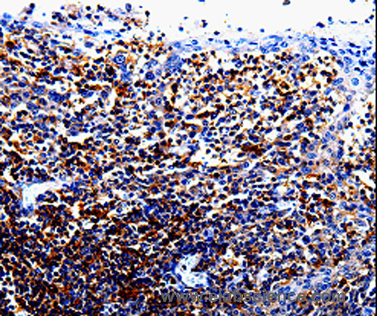 Immunohistochemistry of paraffin-embedded Human tosil tissue using IL10RA Polyclonal Antibody at dilution 1:60