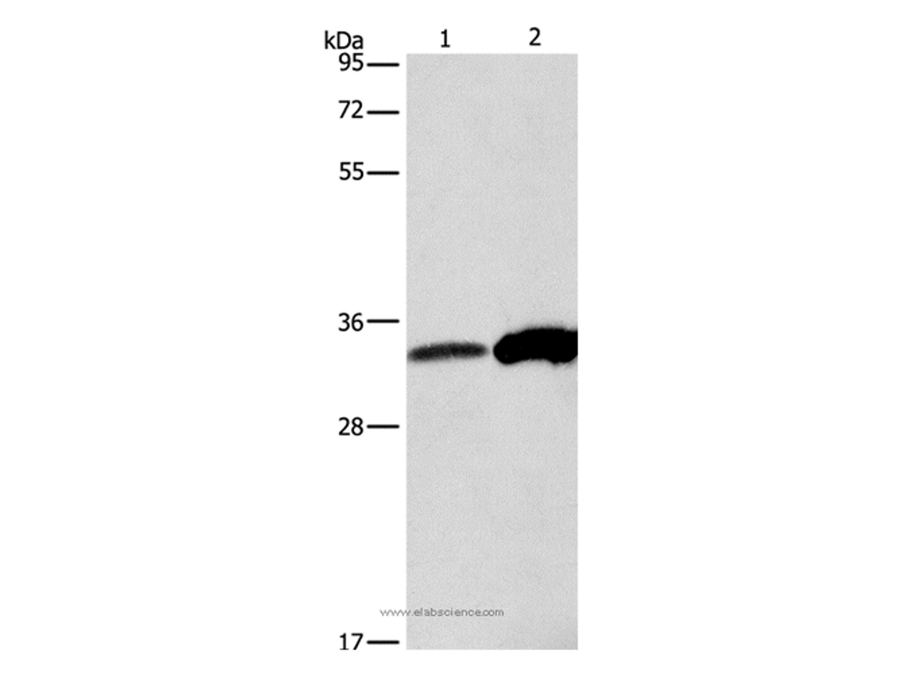 Western Blot analysis of Raw264.7 cell and Human fetal liver tissue using ANXA4 Polyclonal Antibody at dilution of 1:500