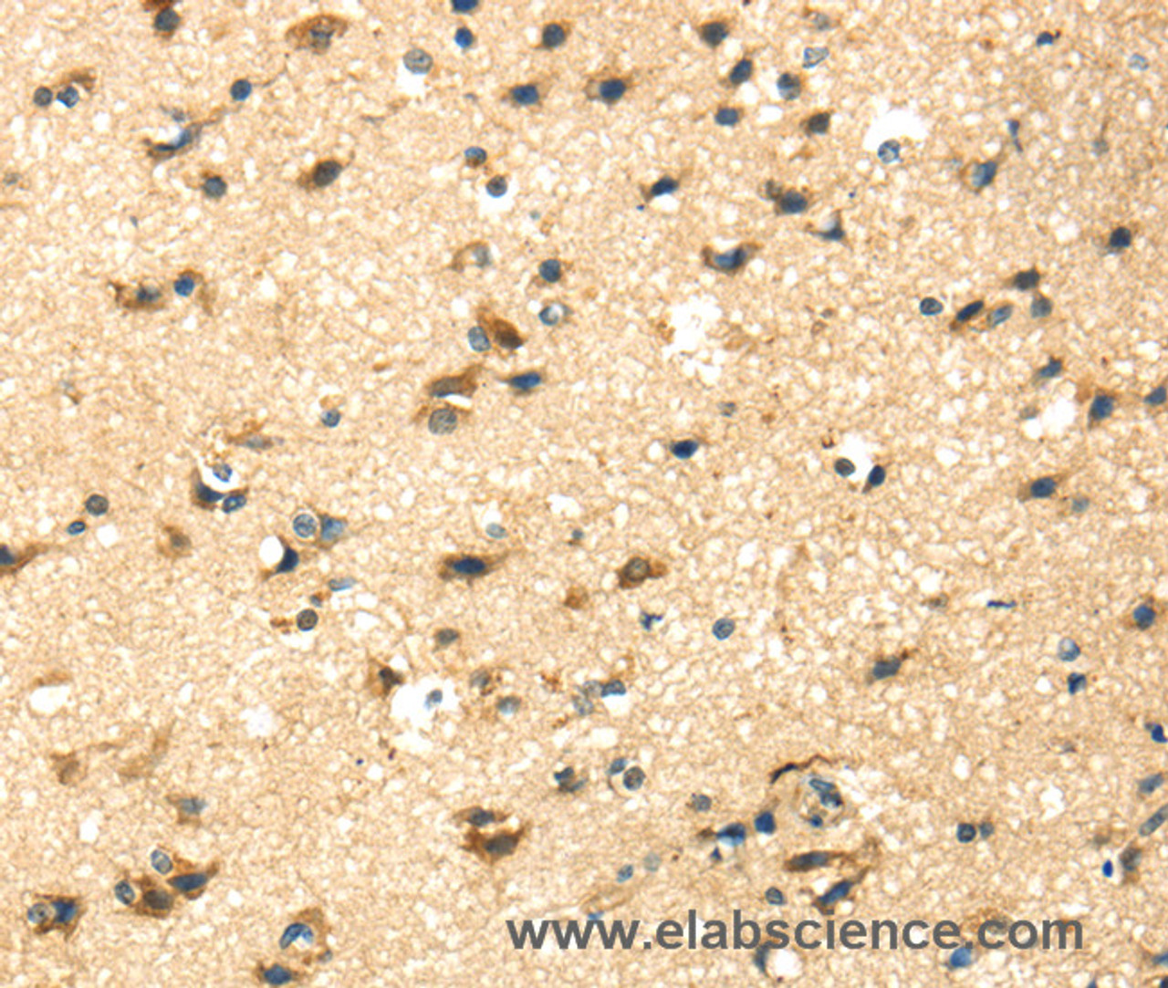 Immunohistochemistry of paraffin-embedded Human brain tissue using CK-17 Polyclonal Antibody at dilution 1:40