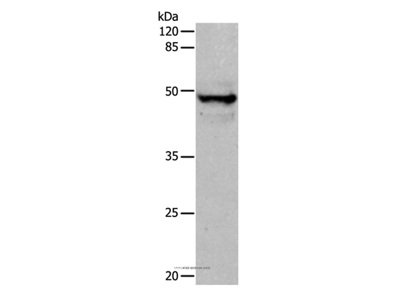 Western Blot analysis of Mouse thymus tissue using CK-15 Polyclonal Antibody at dilution of 1:400