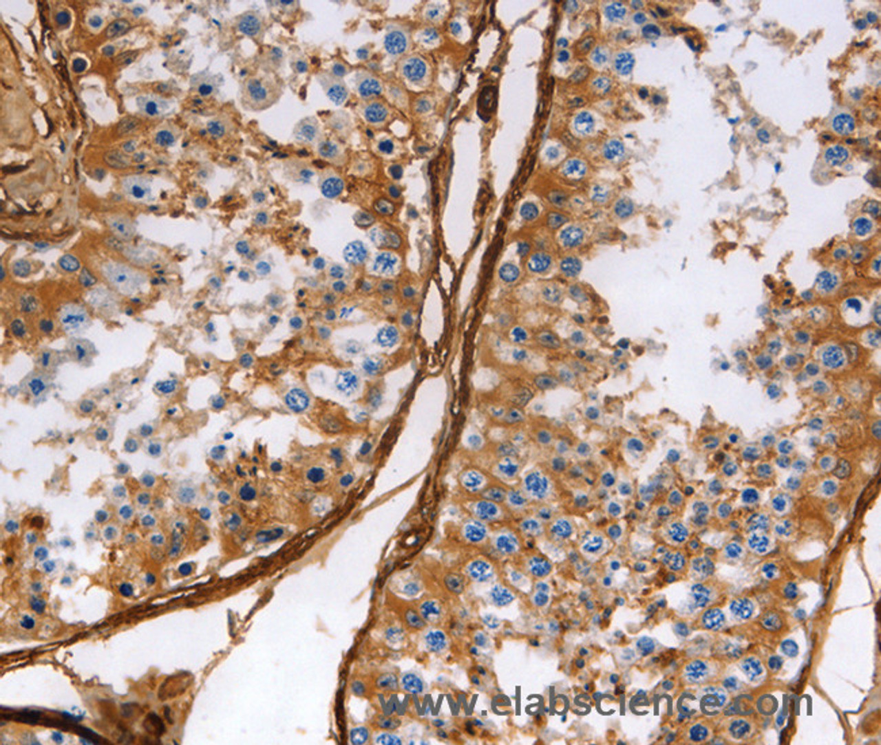 Immunohistochemistry of paraffin-embedded Human testis using Caldesmon Polyclonal Antibody at dilution of 1:40