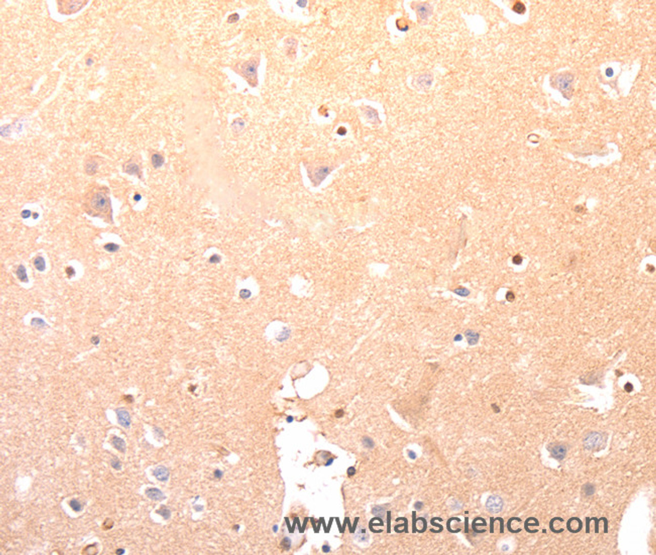 Immunohistochemistry of paraffin-embedded Human brain using CAPNS1 Polyclonal Antibody at dilution of 1:60