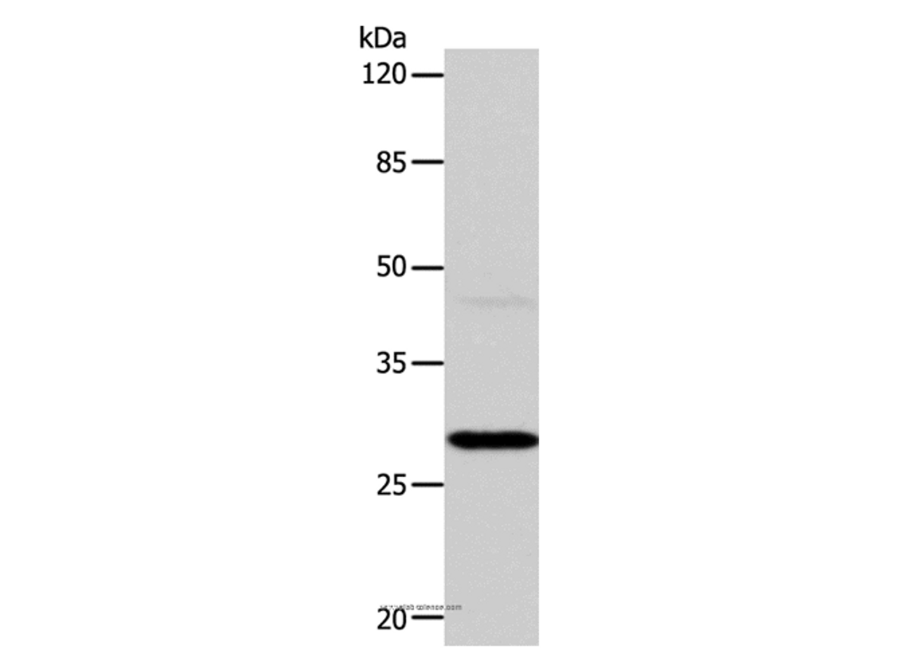 Western Blot analysis of Mouse liver tissue using CA1 Polyclonal Antibody at dilution of 1:450