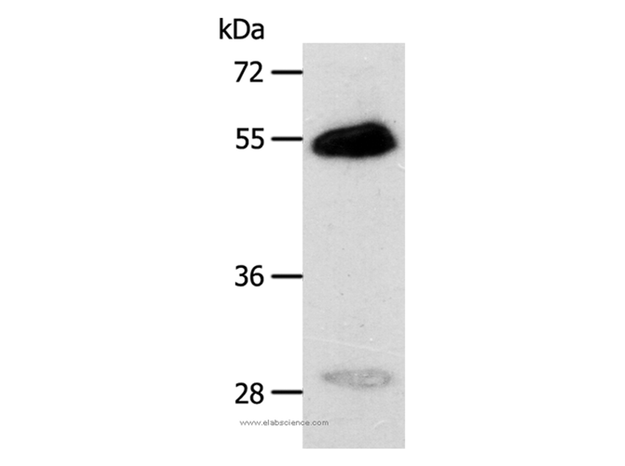 Western Blot analysis of Human liver cancer tissue using CA14 Polyclonal Antibody at dilution of 1:400