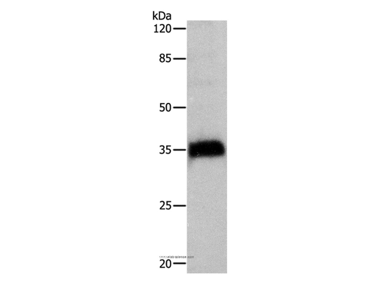 Western Blot analysis of Hela cell using CTSZ Polyclonal Antibody at dilution of 1:500
