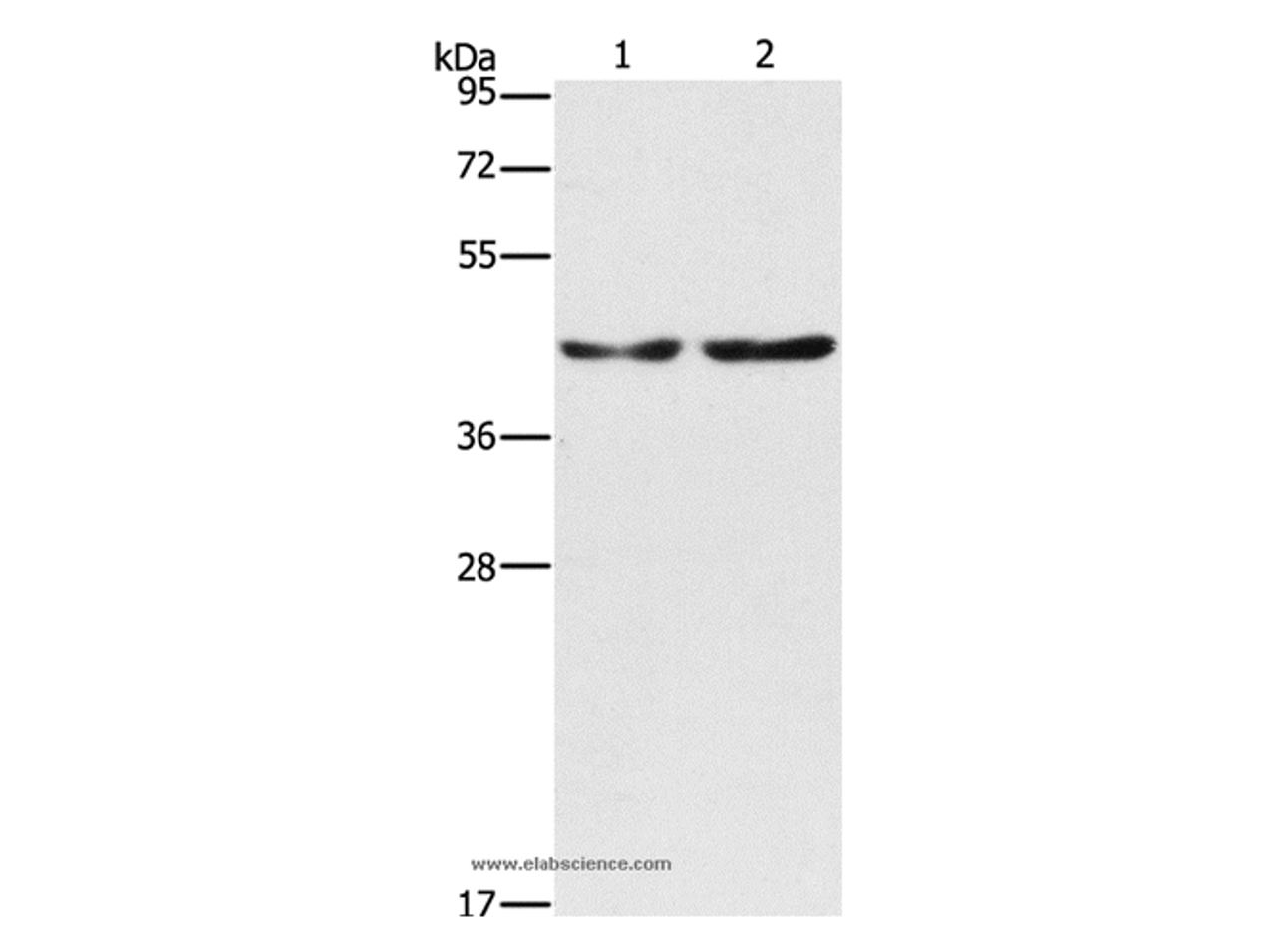 Western Blot analysis of Hela and 293T cell using CBX6 Polyclonal Antibody at dilution of 1:600