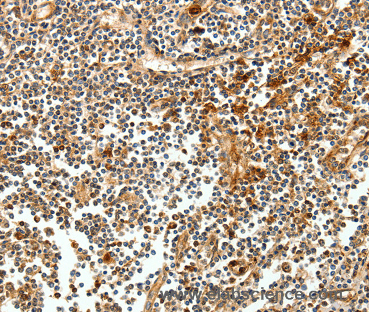 Immunohistochemistry of paraffin-embedded Human tonsil tissue using CEACAM21 Polyclonal Antibody at dilution 1:60