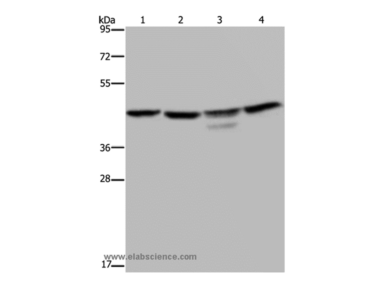 Western Blot analysis of K562 and 293T cell, Jurkat cell and Mouse brain tissue using CSNK2A1 Polyclonal Antibody at dilution of 1:300