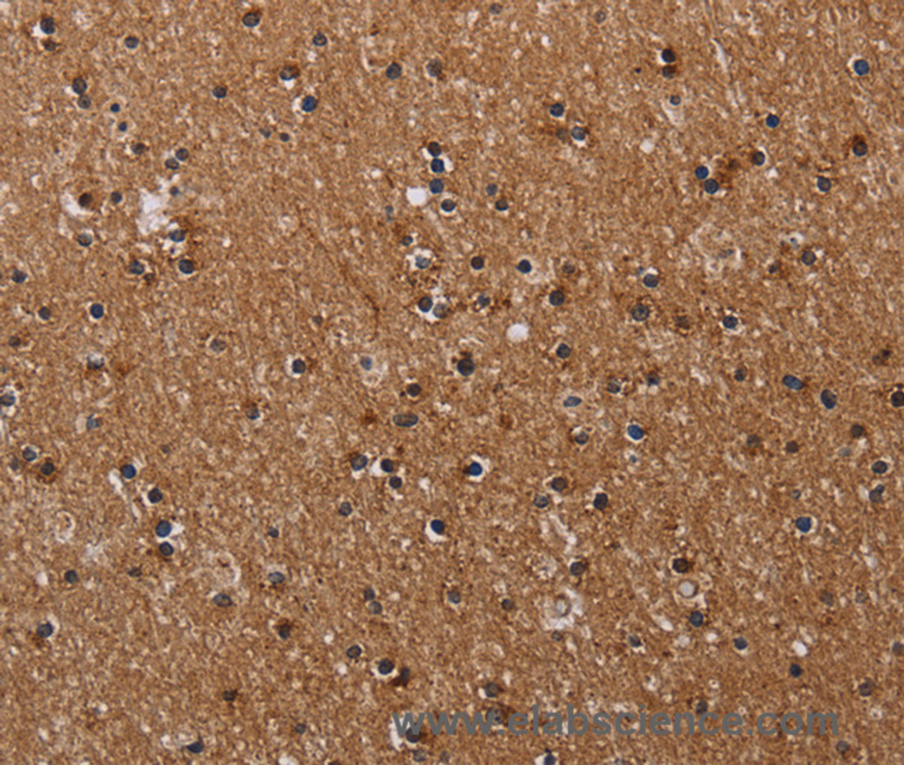 Immunohistochemistry of paraffin-embedded Human brain  tissue using CLDND1 Polyclonal Antibody at dilution 1:40