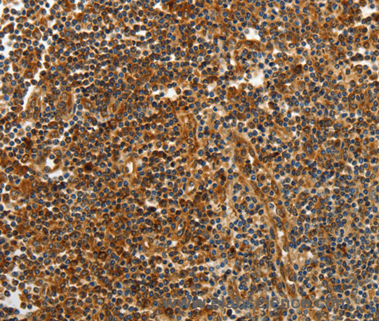 Immunohistochemistry of paraffin-embedded Human tonsil tissue using CNNM3 Polyclonal Antibody at dilution 1:40