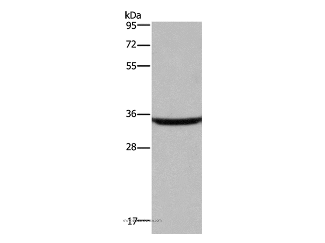 Western Blot analysis of Human fetal brain tissue using DKK3 Polyclonal Antibody at dilution of 1:200