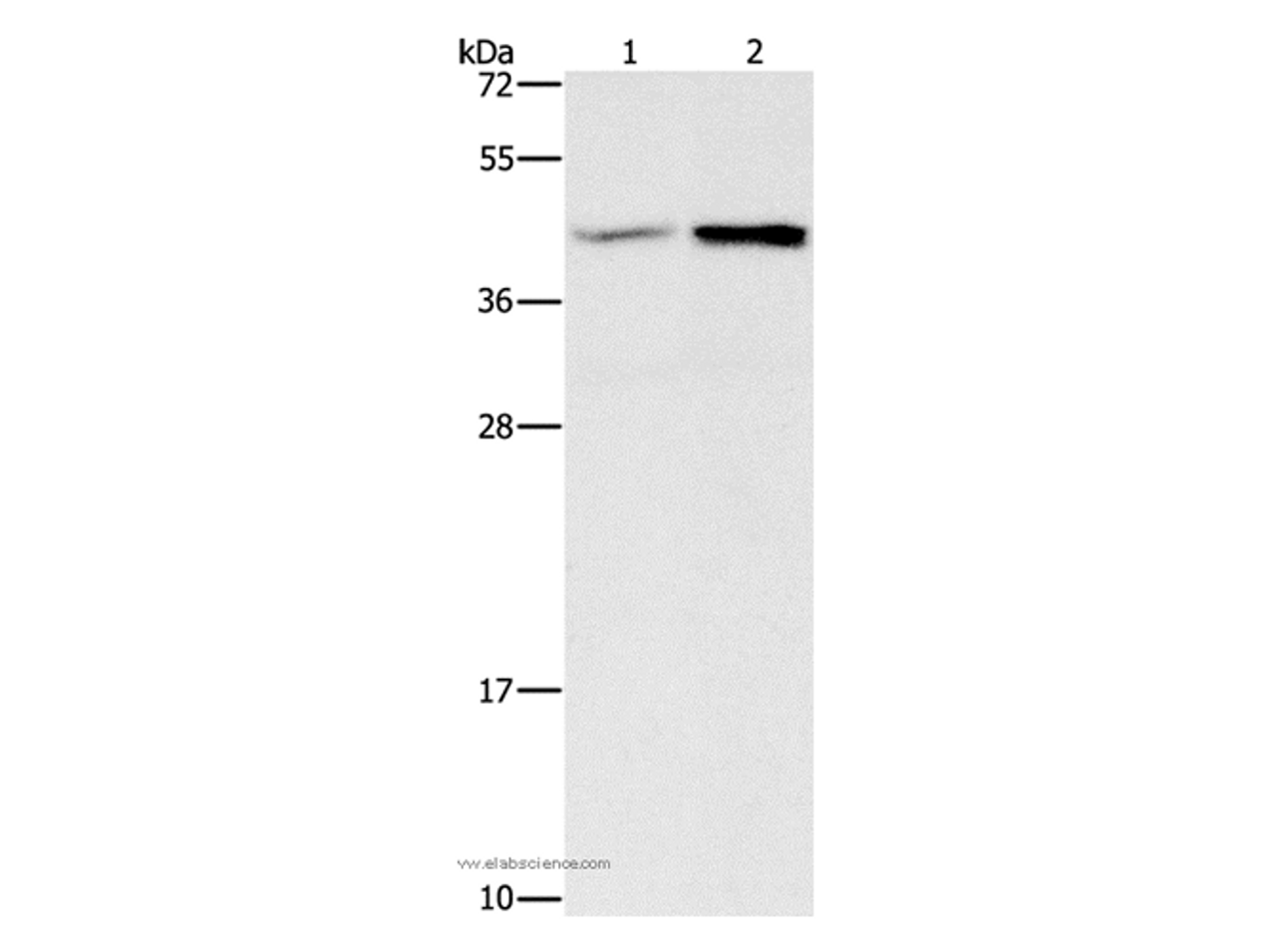 Western Blot analysis of Human fetal brain and Mouse heart tissue using GNB5 Polyclonal Antibody at dilution of 1:550